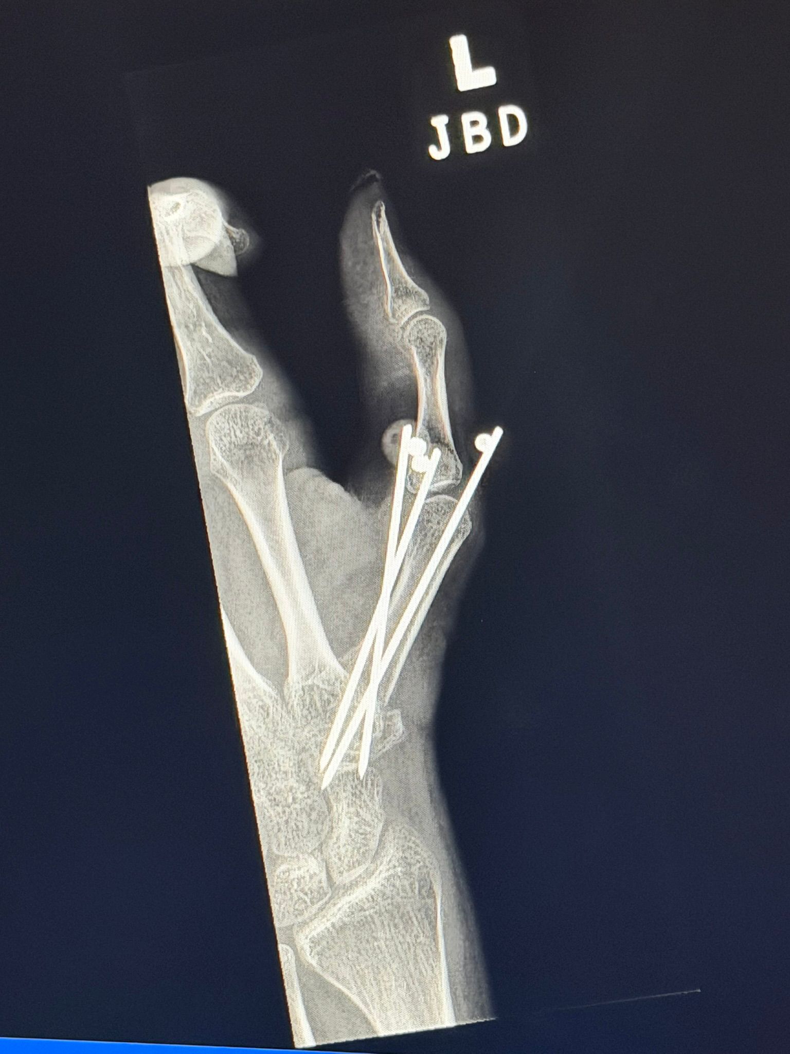 Imagen de la galería